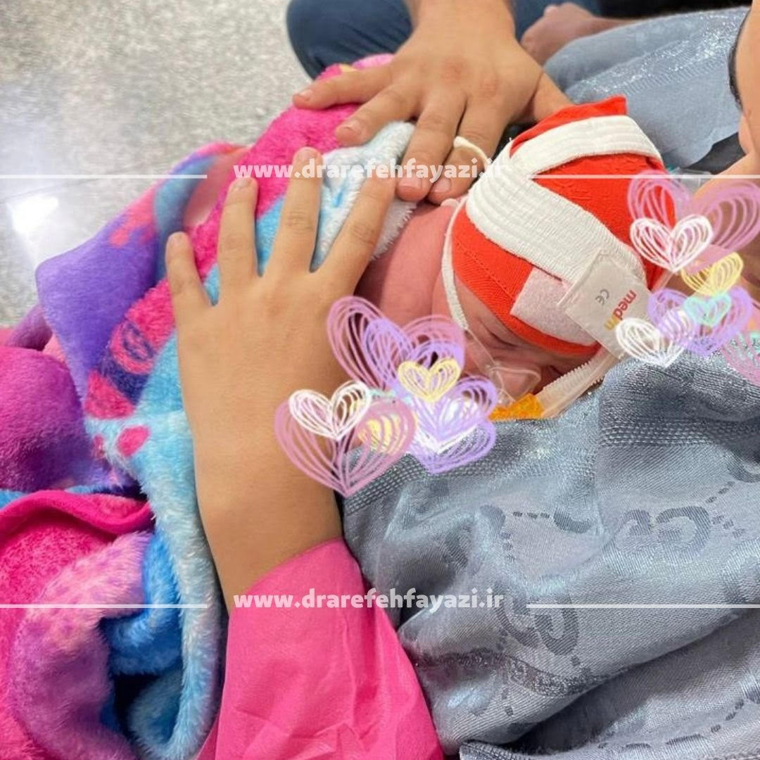 مراقبت کانگورویی